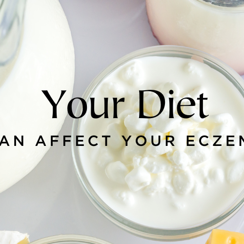 Did you know your diet can affect your eczema?