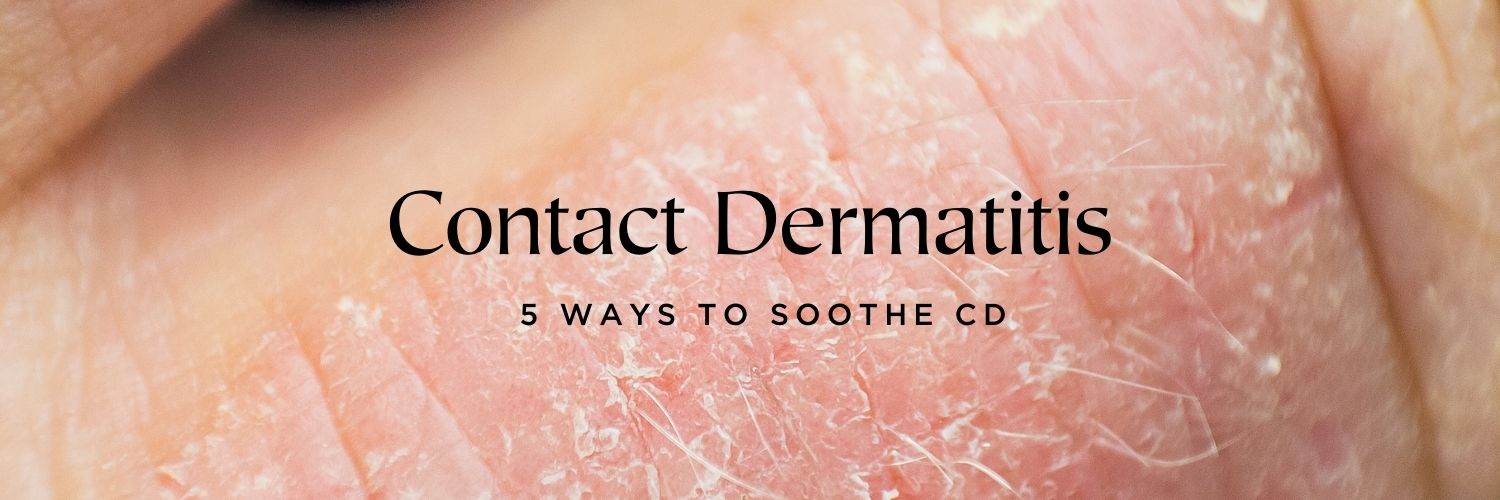5 Ways to Soothe Contact Dermatitis