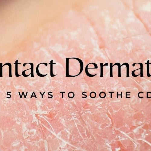 5 Ways to Soothe Contact Dermatitis