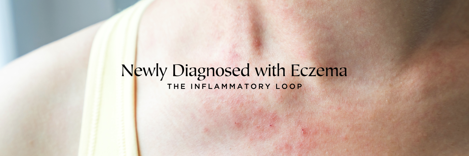 Newly Diagnosed with Eczema