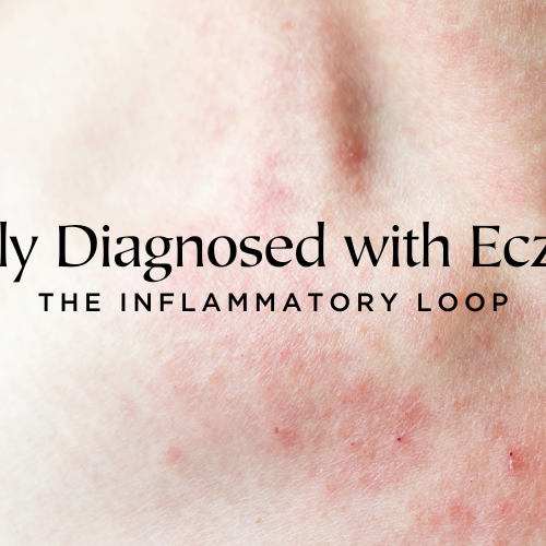 Newly Diagnosed with Eczema
