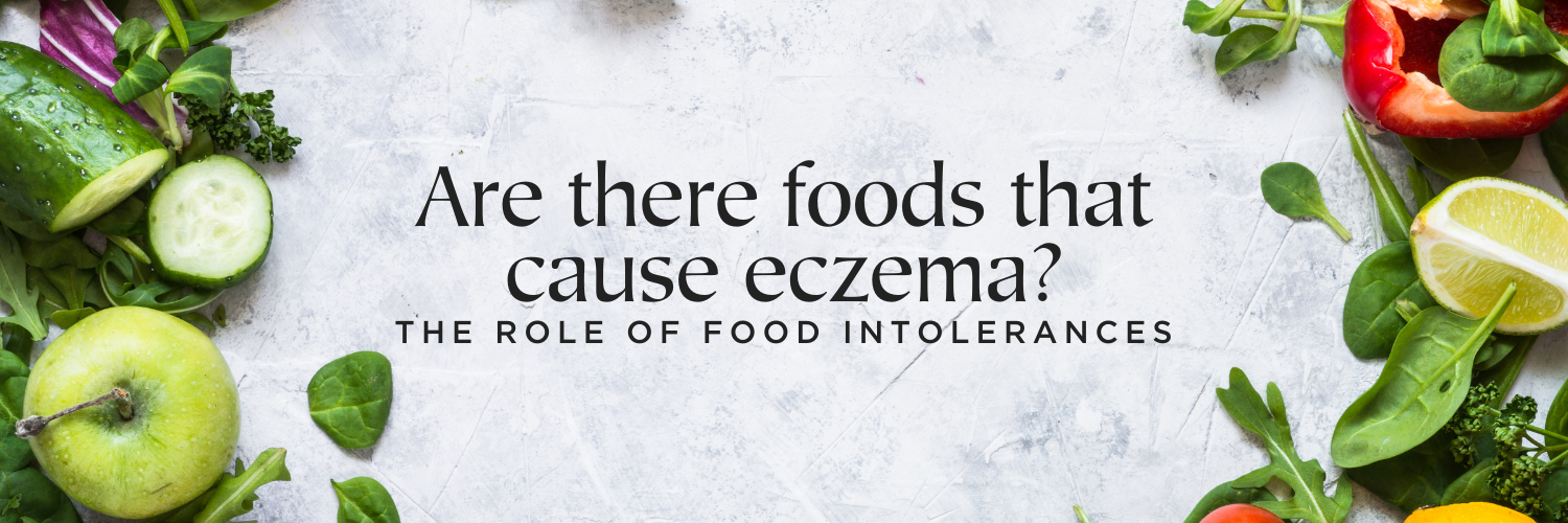 Are there foods that cause eczema?