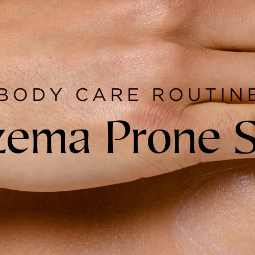 Skin Care Routines for Eczema-Prone Skin