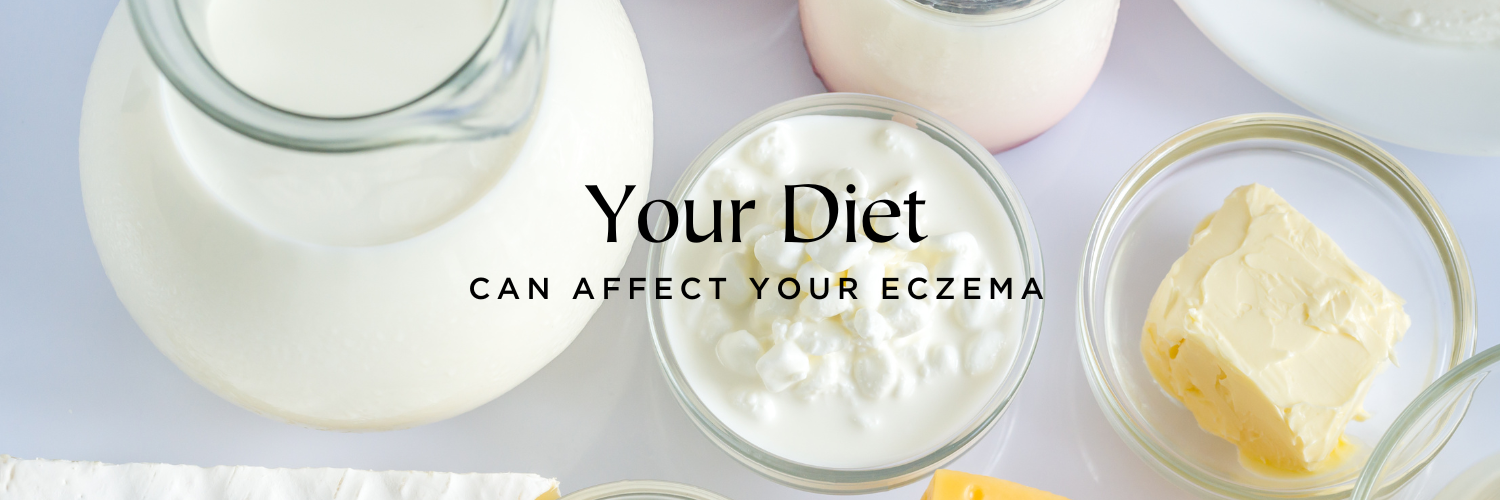 Did you know your diet can affect your eczema?