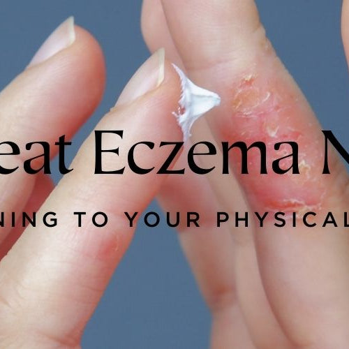 How treat eczema naturally