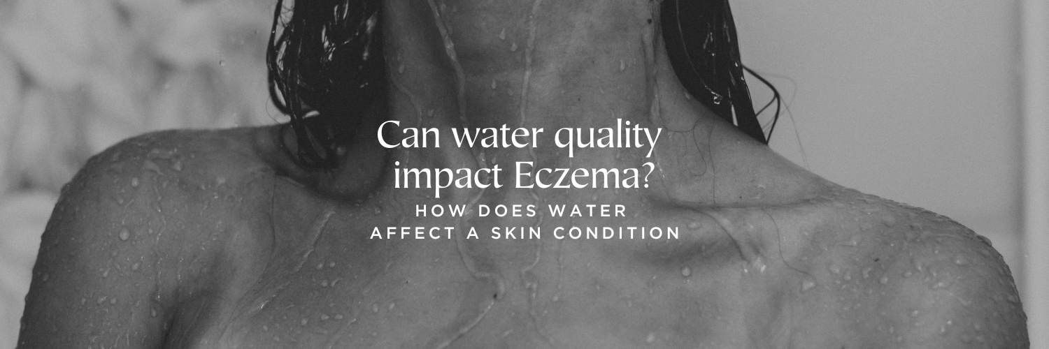 Can water quality impact Eczema?