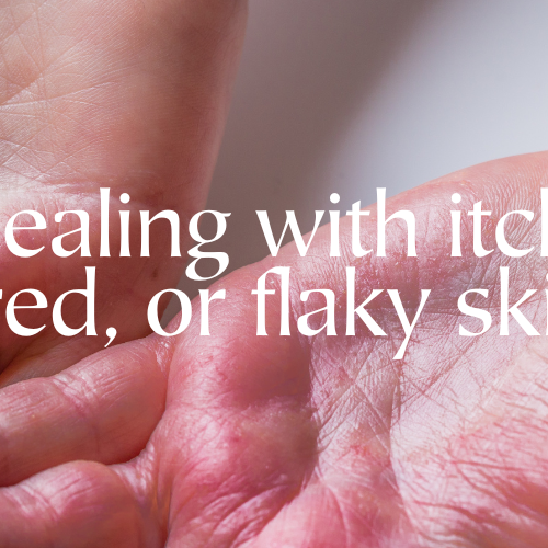 Dealing with itchy, red, or flaky skin