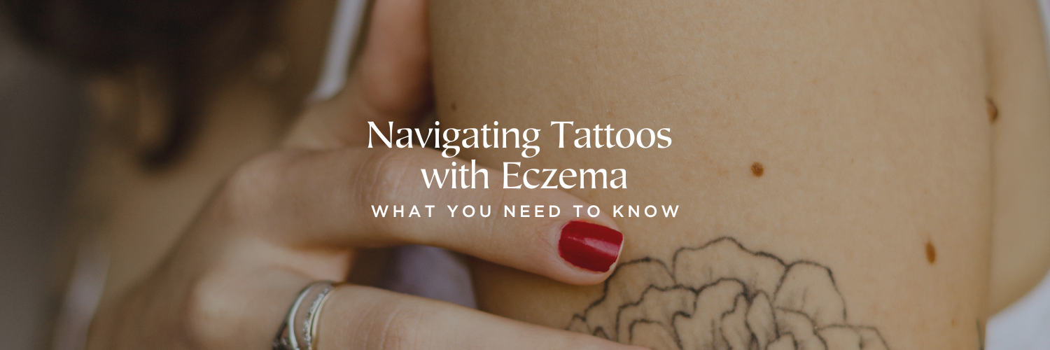 Tattoos with Eczema: What You Need to Know
