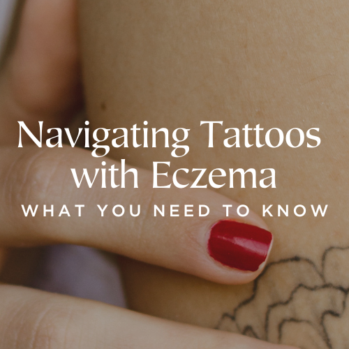 Tattoos with Eczema: What You Need to Know