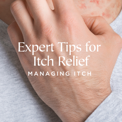 Managing Eczema Itch