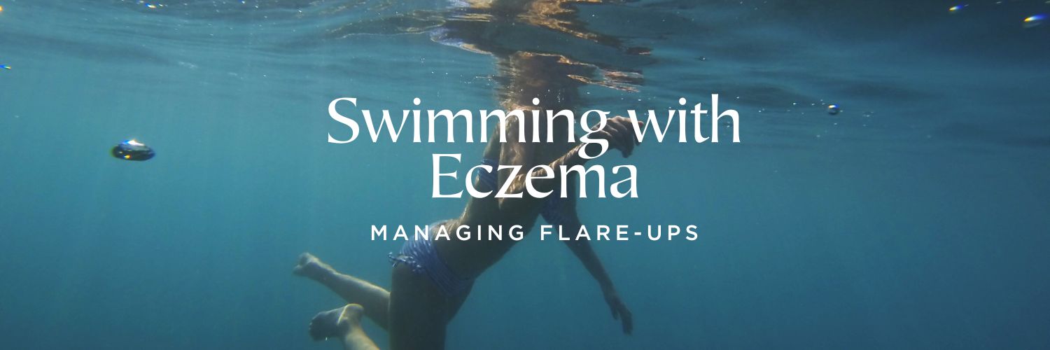 Swimming with Eczema