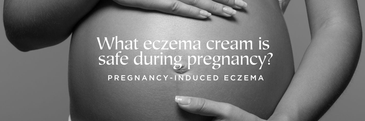 What eczema cream is safe during pregnancy?