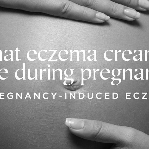 What eczema cream is safe during pregnancy?