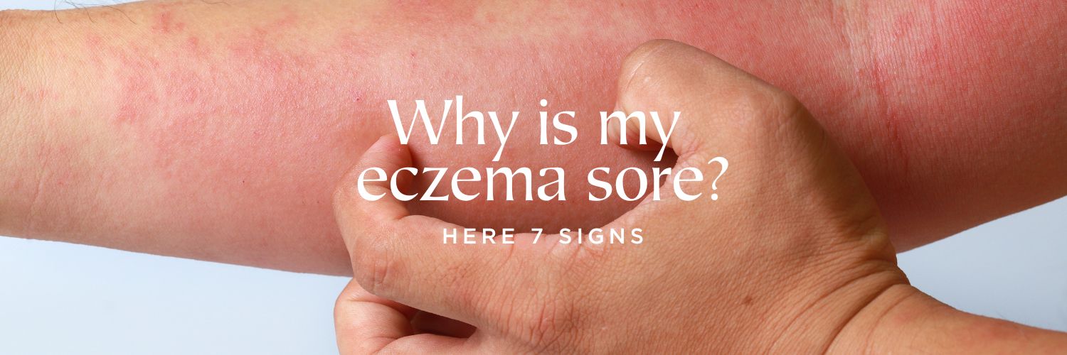 Why is my eczema sore?