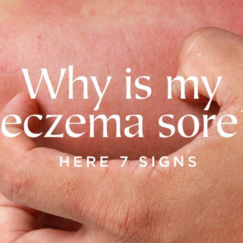 Why is my eczema sore?