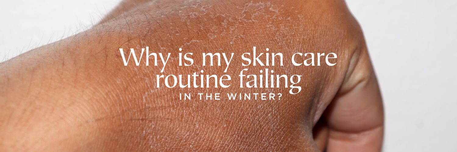 Why is my skin care routine failing in the winter?