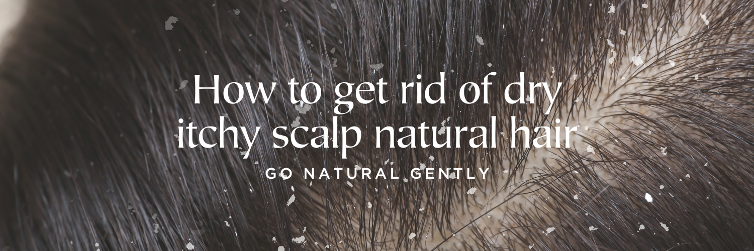 How to get rid of dry itchy scalp natural hair?